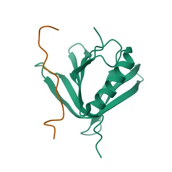 Anti-SMEK1 Polyclonal Antibody for WB, IHC-P, ELISA - Q6IN85